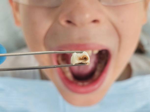 Best Dentist for Dental Trauma  in Pocatello, ID